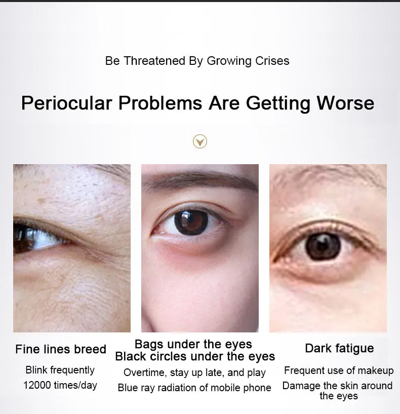 30g Polypeptide Eye Cream Tighten And Prevent Puffiness Under Circle Remover